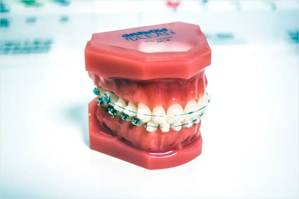 Detail Orthodontic Braces Smile Close Up Number 13