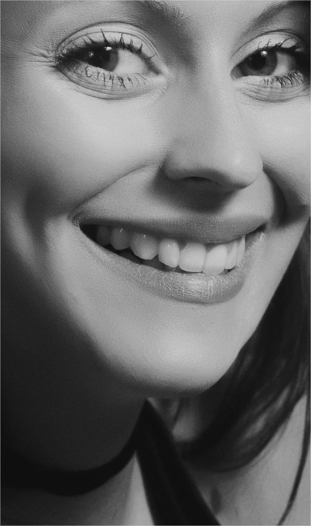 Detail Orthodontic Braces Smile Close Up Number 14