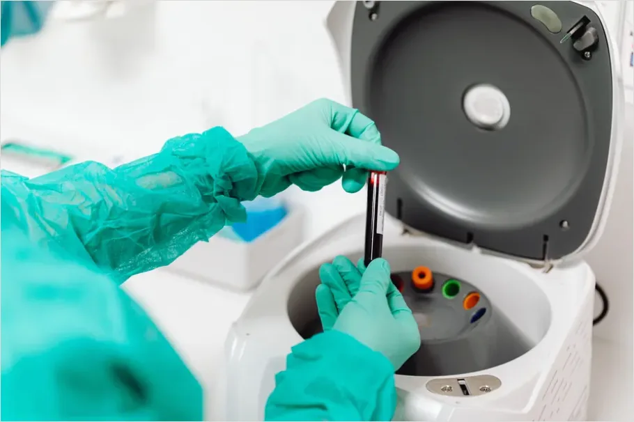 Detail Laboratory Technician Analyzing Blood Sample Number 2