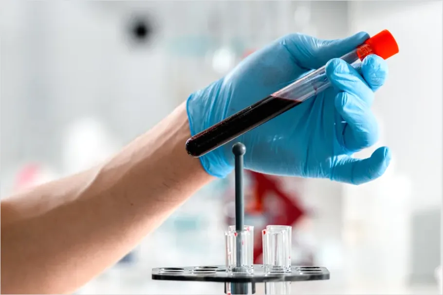 Detail Laboratory Technician Analyzing Blood Sample Number 11