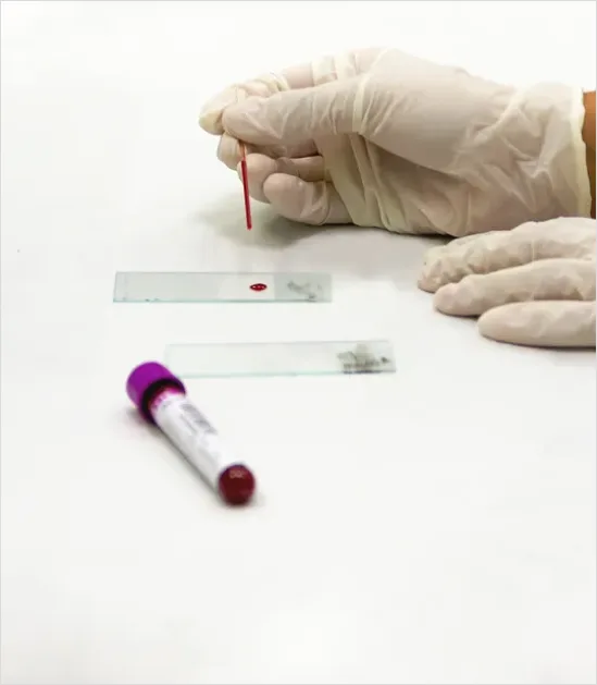 Detail Laboratory Technician Analyzing Blood Sample Number 13