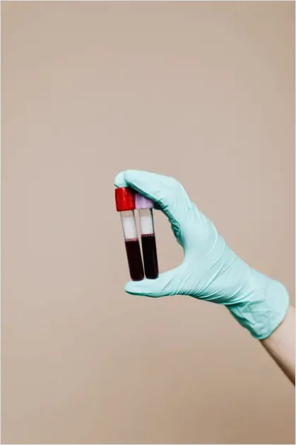 Detail Laboratory Technician Analyzing Blood Sample Number 16