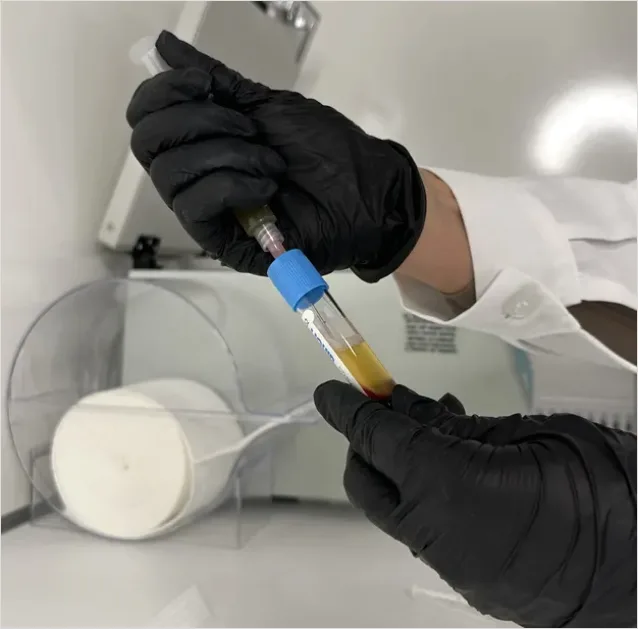 Detail Laboratory Technician Analyzing Blood Sample Number 4