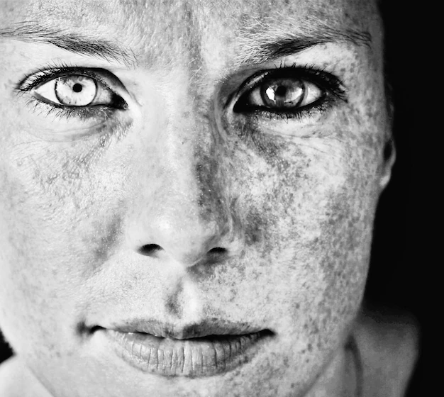 Detail Freckled Face Portrait Close Up Number 14