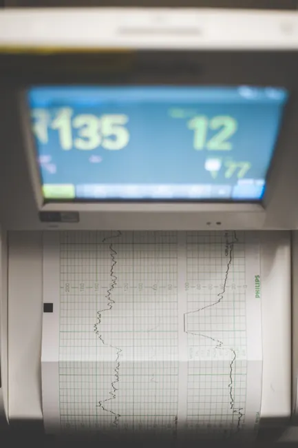 Detail Heart Rate Monitor Chest Strap Setup Number 5