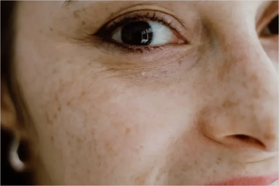 Detail Skin Texture Portrait Close Up Number 15